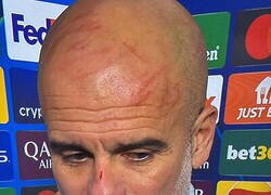 Enlace a Los arañazos en la cabeza de Pep también lo predijeron Los Simpson