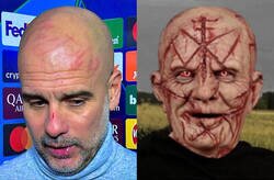 Enlace a Separados al nacer