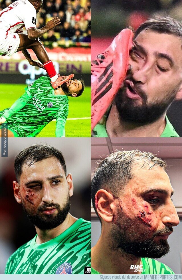 1213352 - Esto de Donarumma es de lo más bestial que he visto en un campo de fútbol