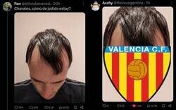 Enlace a Turquía se frota las manos