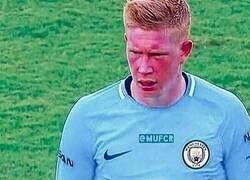 Enlace a Echaremos de menos esos cambios cromáticos en su cara