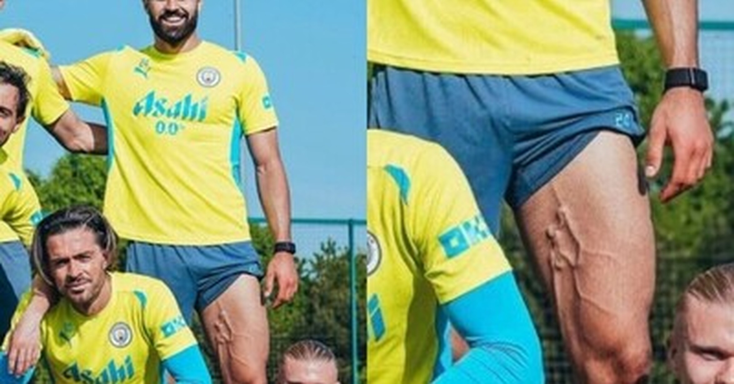 Gvardiol, esto definitivamente es un problema vascular