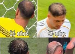 Enlace a Preocupante esto a esta edad