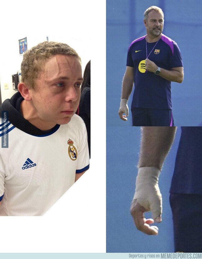 1227895 - Los madridistas están nerviosos al ver la mano de Flick