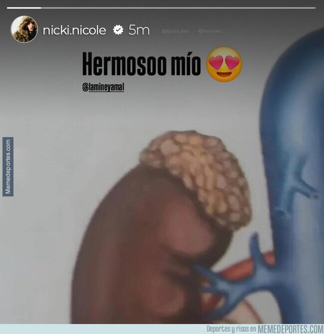 1228573 - Está muy enamorada