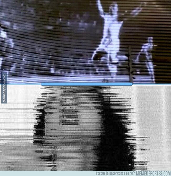 1228783 - Ah, pero si pones una radiografía delante se ve bien