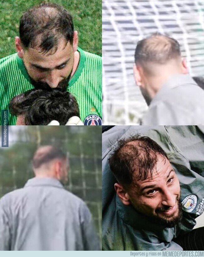 1229698 - A sus 26 años Donnarumma ha perdido una dolorosa batalla