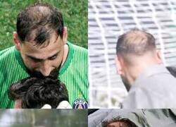 Enlace a A sus 26 años Donnarumma ha perdido una dolorosa batalla