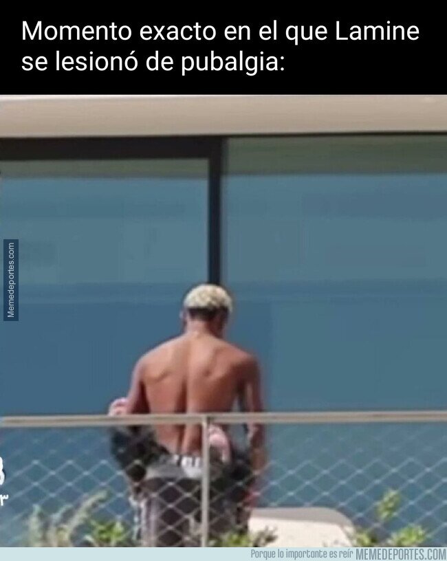 1232345 - Exceso de uso del pubis