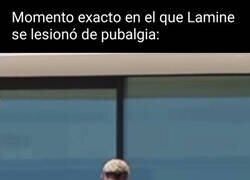 Enlace a Exceso de uso del pubis