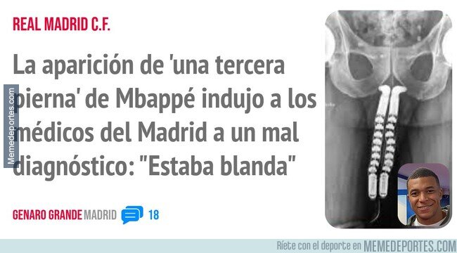 1237867 - Errores humanos, por supuesto