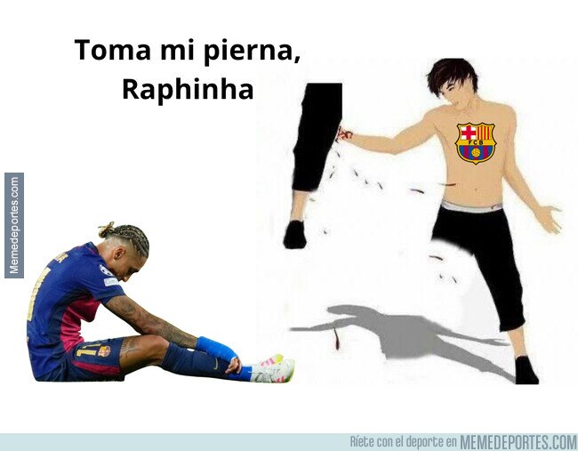 1237996 - Los culés ahora mismo con la lesión de Raphinha