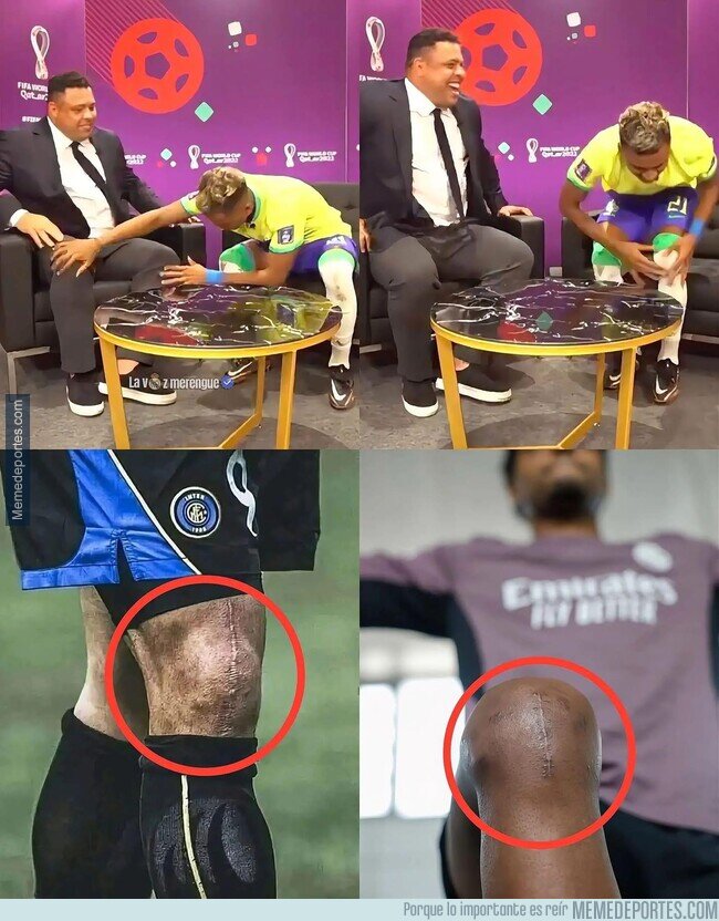 1240235 - El que quería las rodillas de Ronaldo