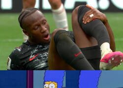 Enlace a Escalofriante lesión de Koné