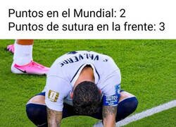 Enlace a Más puntos en la frente que en el Mundial