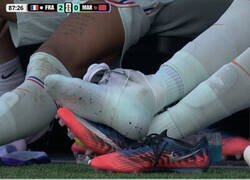 Enlace a Mbappé se retiró del partido por lesión