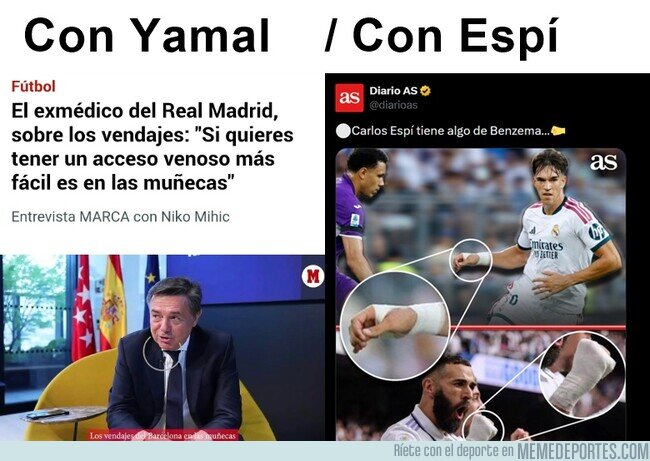 1244364 - Los catedráticos del relato opinan sobre vendajes en las manos
