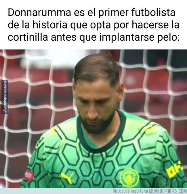1244907 - Donnarumma se peina a la antigua