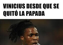 Enlace a Que vuelva el Vinicius feo