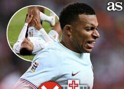 Enlace a Curioso método de recuperación el de Mbappé