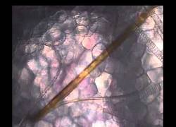 Enlace a Esto es lo que pasa cuando te pica un mosquito