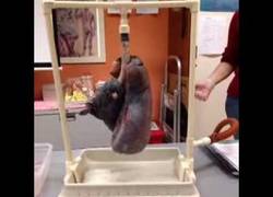 Enlace a ¿Cuál es la diferencia entre el pulmón de un fumador y el de un no fumador?