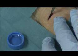 Enlace a Crean un gel con nanopartículas para pegar tejidos biológicos y suturar heridas