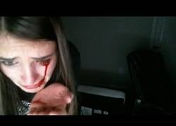 Enlace a No todos los gatos son mansos. Éste casi le saca un ojo a su dueña