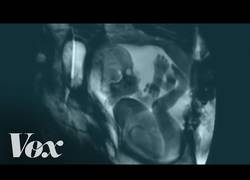 Enlace a Así se ve una pareja besándose a través de una resonancia magnética