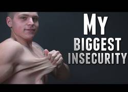 Enlace a Un chico se desnuda para mostrarte las consecuencias en su piel al perder 73 kg