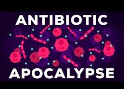 Enlace a El apocalipsis de los antibióticos