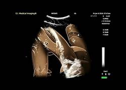 Enlace a Vas a alucinar como se ve la ecografía de un tiburón
