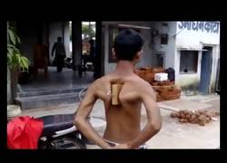 Enlace a Este chico es capaz de arrastrar un coche solo con los huesos de su espalda