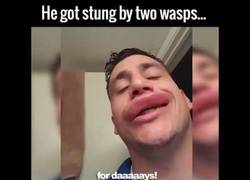 Enlace a Nada mejor que bromear cuando te pican unas avispas en los labios
