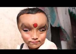 Enlace a Niño con una rara condición es considerado un Dios en India (ingles)