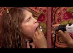 Enlace a Analizan las cuerdas vocales de Steven Tyler