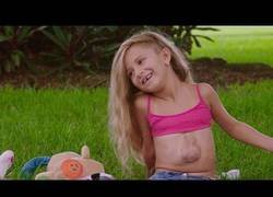 Enlace a La historia de la niña que vive con el corazón fuera del pecho