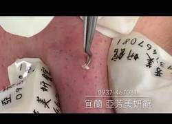 Enlace a El arte de limpiar un grano [Abstenerse sensibles]