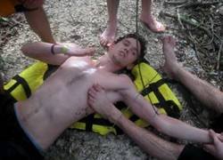 Enlace a Se disloca el hombro y le explica a sus colegas de aventura como ponerlo en su sitio