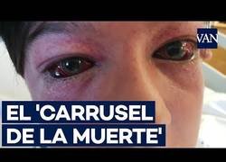 Enlace a Presionaron a un chaval y huyeron cuando necesitaba ayuda