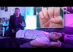 Enlace a Así superó su gran adicción: morderse las uñas