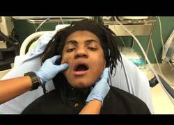 Enlace a Así se coloca una mandíbula dislocada