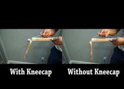 Enlace a ¿Para qué sirve la rótula? [Inglés]