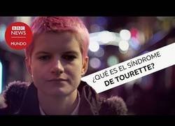 Enlace a El síndrome de Tourette