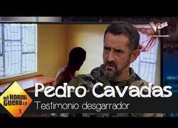 Enlace a Entrevistan en El Hormiguero a Pedro Cavadas, el cirujano más solidario del mundo