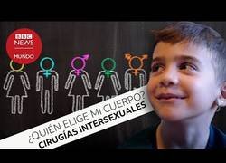 Enlace a Cirugías intersexuales