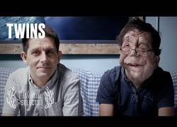 Enlace a Dos gemelos que no se parecen en nada [Inglés]