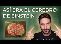 Enlace a ¿Qué tiene el cerebro de Einstein que no tenga el tuyo?