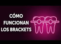 Enlace a ¿Cómo funcionan exactamente los brackets?