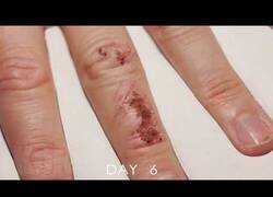 Enlace a Así se curaría una herida si en lugar de un mes tardara 10 segundos